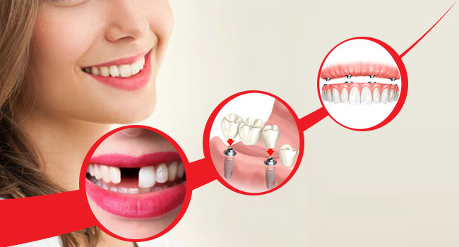 Looking for a dentist for the dental treatment in near by location